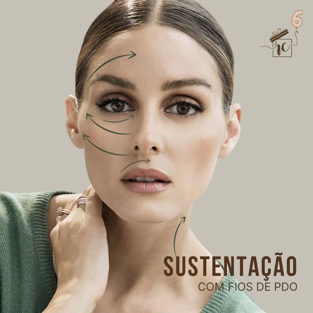 SUSTENTAÇÃO COM FIOS DE PDO